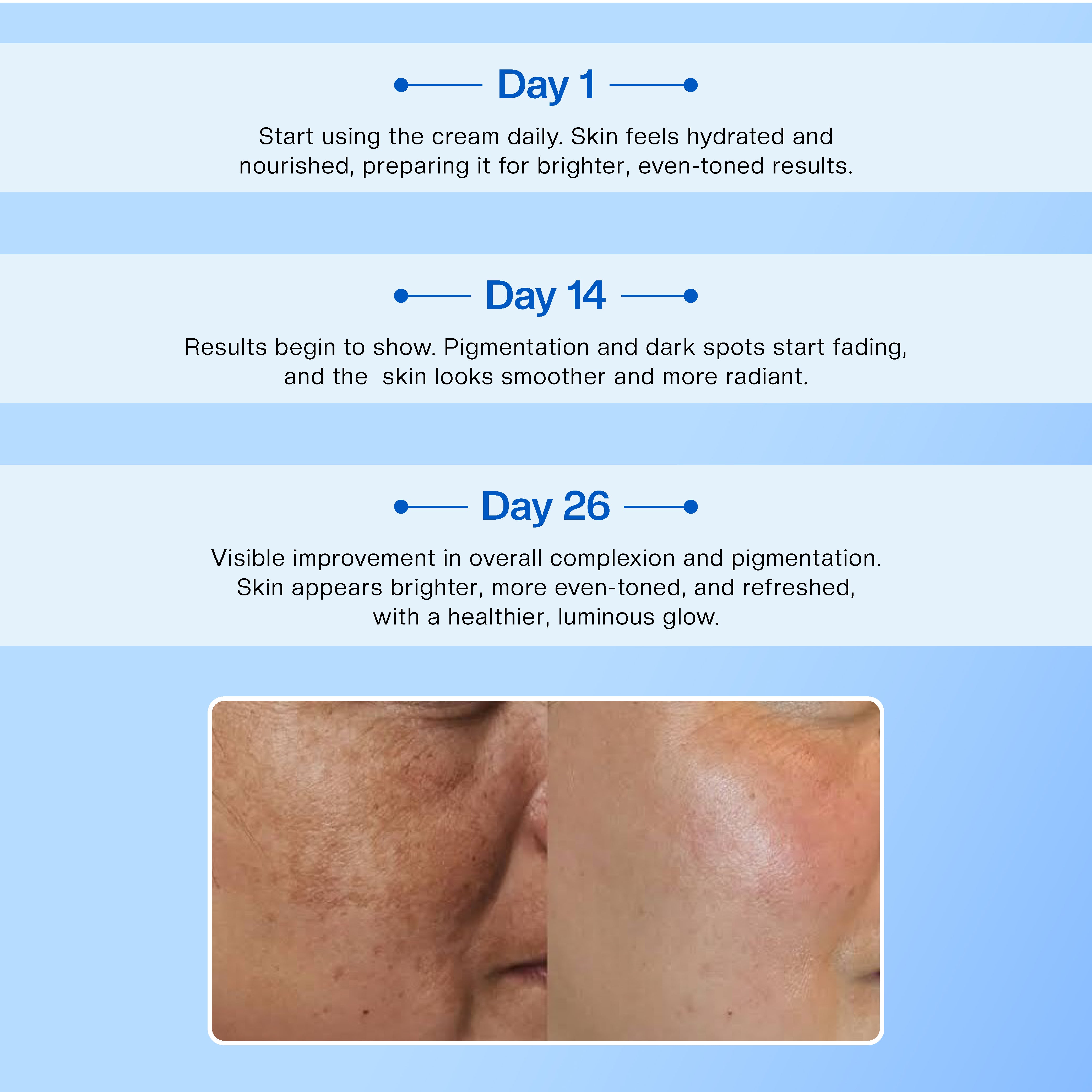 MelaClear Derma Cream (Buy 1 Get 1 Free 🎁)